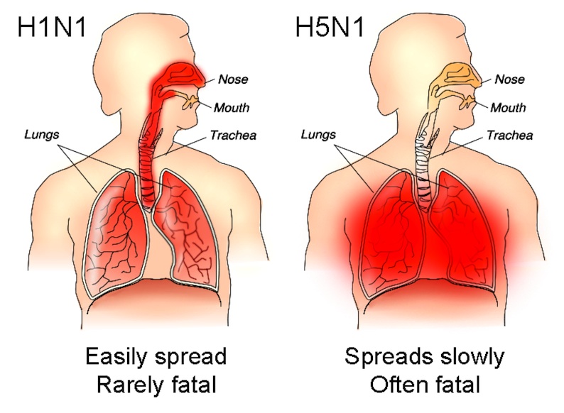 * HN1-lung-chart.jpg